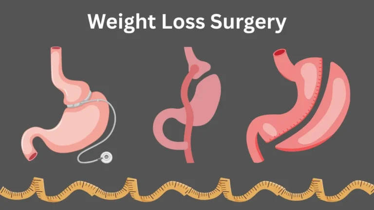 Medication Management After Weight Loss Surgery weight loss surgery